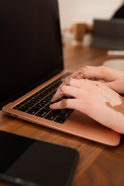 Hands with rings typing on laptop